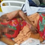 Filha incendeia casa onde mãe foi queimada pelo companheiro, em Maceió