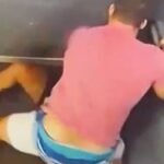 Mulher agredida com 60 socos pode ficar com sequelas, diz cirurgião