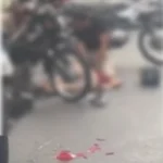 Motociclista fica ferido após acidente com carro e caminhão em Maceió