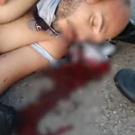 Ciclista fica em estado gravíssimo após ser atropelado por caminhão na AL-220, em Arapiraca