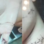 Homem é preso por tentativa de feminicídio após atacar jovem a facadas enquanto ela dormia em Maceió