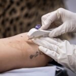 Gestão JHC marca avanço histórico na saúde da mulher com inserção gratuita do Implanon