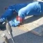 Motociclista fica ferido após colidir com caminhão em Rio Largo