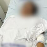 Mulher denuncia tentativa de feminicídio após ataque de ex-companheiro em Murici
